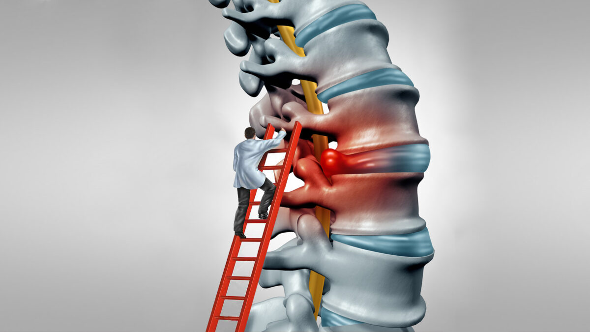 Tratamentul artrozei articulațiilor vertebrale costale