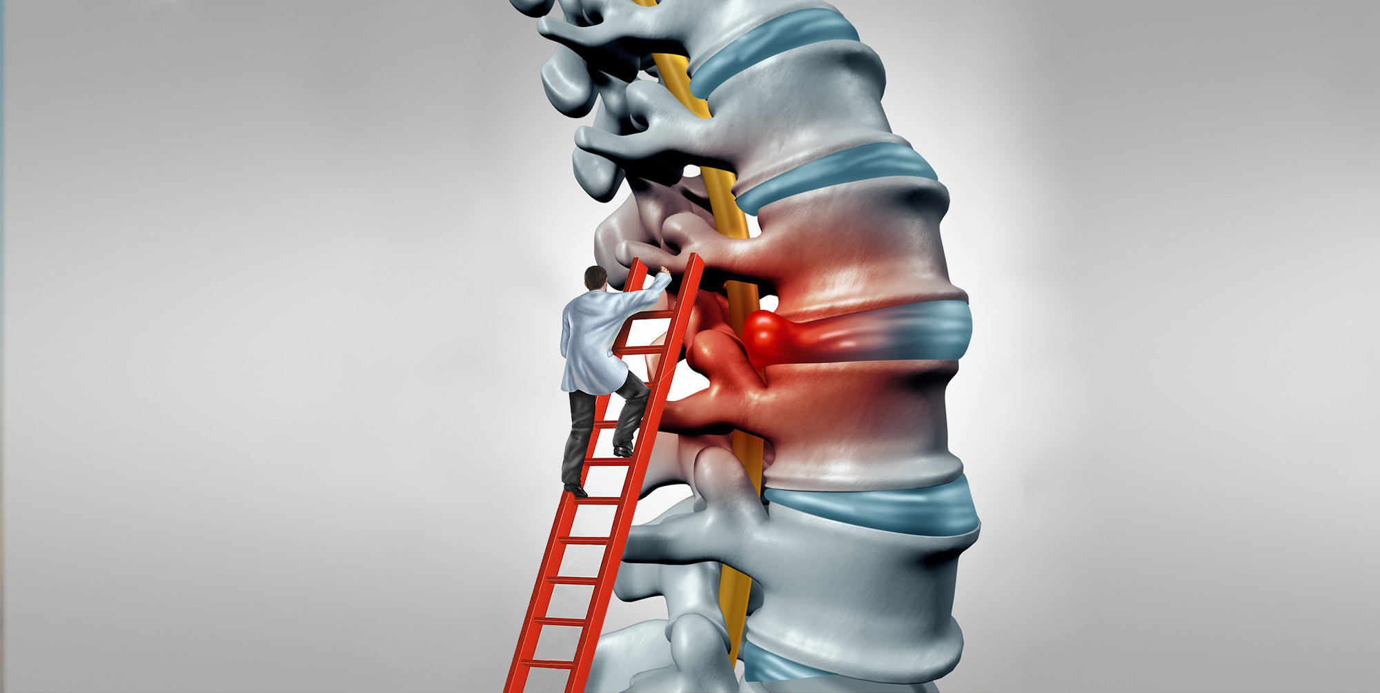 metode de tratament al coloanei vertebrale